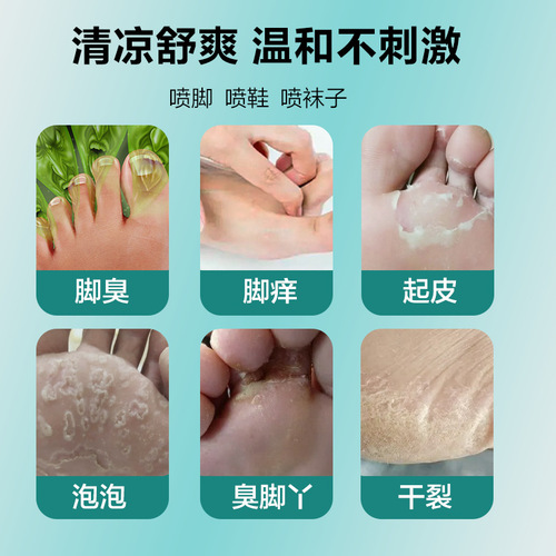 Nan Ci Tang Mugwort Skin Cleansing Liquid Wolfsbane Athlete's Foot King's Stinky Feet Athlete's Foot Water Peeling Rotten Feet Athlete's Foot Cream Anti-Itching Spray