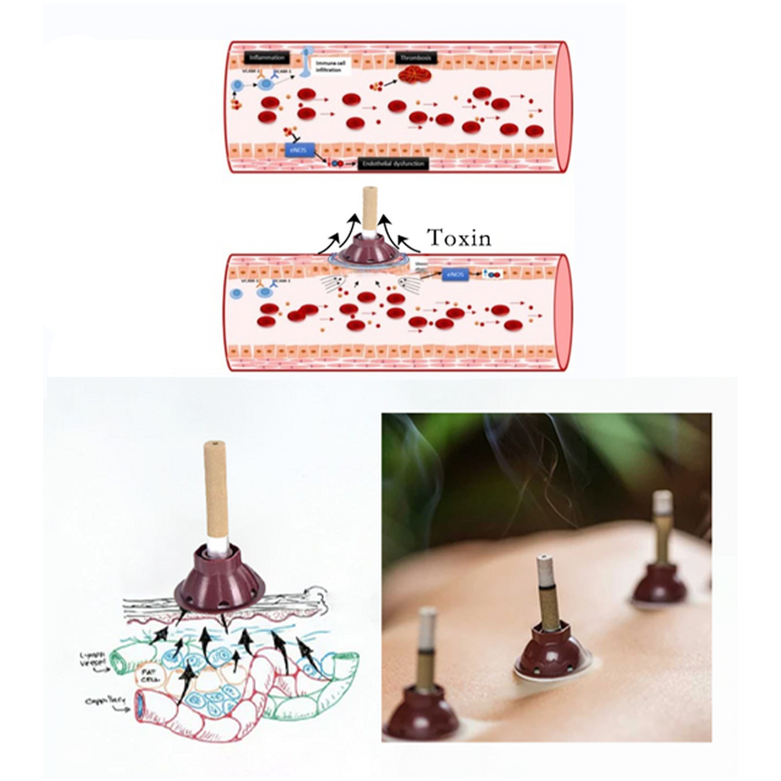 EELHOE body shaping combustion column expels impurities from beautifies body, tightens the abdomen,_voghion.com