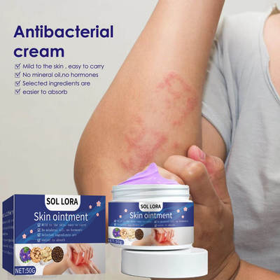 SOL LORA purple flower skin anti-itching cream for external use mosquito bites skin itching anti-itching cream