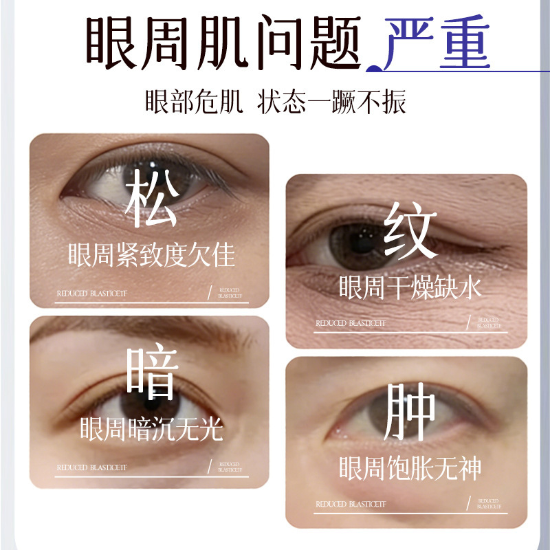 Heparina de sodio de Suxiu Chen crema para mejorar el tono de la piel oscura y suave reducir los poros control de aceite humectante fabricante image 3
