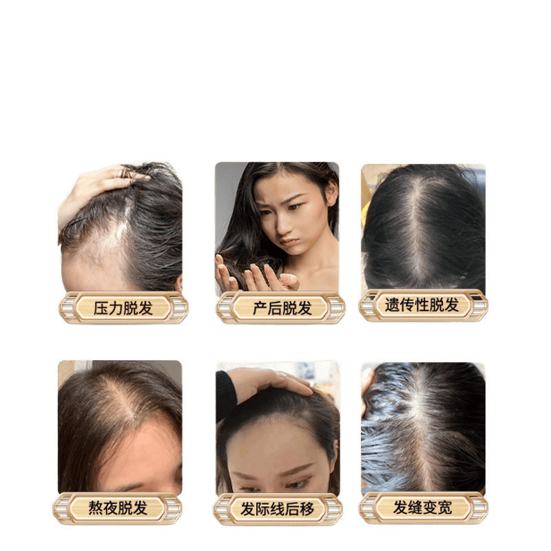 瑶品防脱育发洗发水养发护发洗发水育发染发|undefined