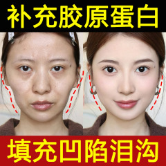 コラーゲン原液は、くぼみ、リフトアップ、引き締め、カテゴリー3組換え、ほうれい線除去、エステサロン抗シワエッセンスを満たします。