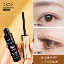 ZkYo��ë���;��AҺ�᝙���}�o�}üë�ۋ}ë���Һ���AҺ��Ʒ���l