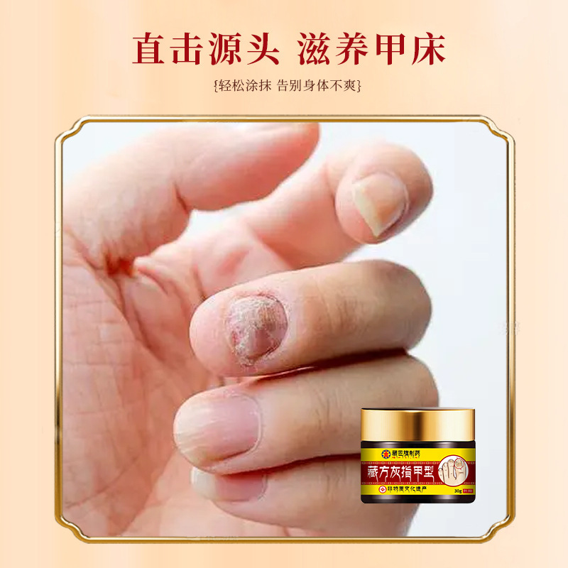 藏巴旗制药灰指甲软甲脱甲膏修甲修脚亮甲专用药水足部护理灰甲液|undefined