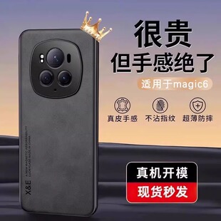 �m�Øsҫmagic6pro�֙C���¿����Ƥhono�R�^ȫ��magic6�����