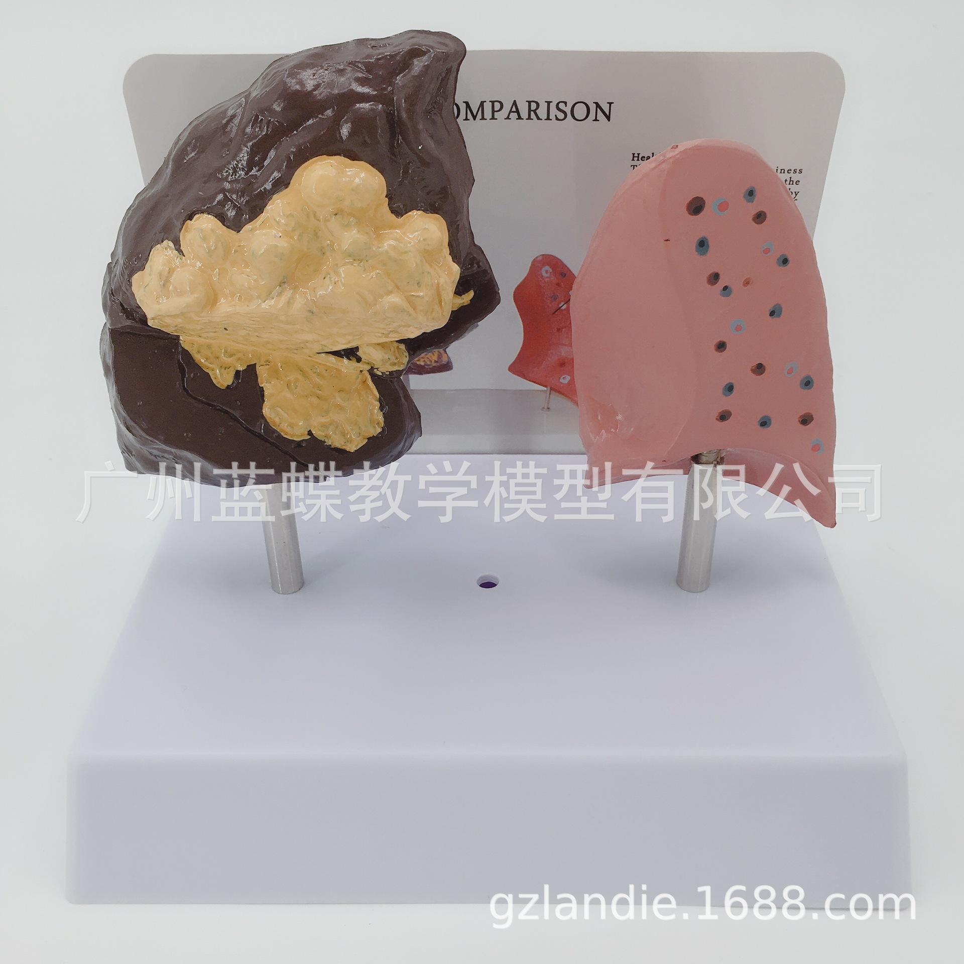 �������ཡ�����벡̬�αȽ�ģ�� �����ν���ģ�� �����ζԱ�ģ��