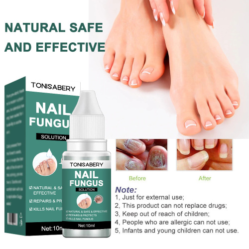 TONISABERY cross-border foreign trade export onychomycosis repair and nourishing solution brightening essence