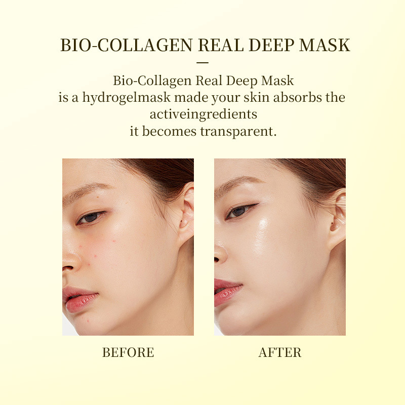 クロスボーダーBIO-COLLAGENバイオコラーゲンマスク美白透明分割型パッチフェイスマスク|undefined