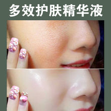 �۲������R�޲�ͪ�Ե��㼃¶ȥ�]�ڷ۴��R�Լ�¶��së��ˬ�wˮ