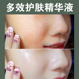 �۲������R�޲�ͪ�Ե��㼃¶ȥ�]�ڷ۴��R�Լ�¶��së��ˬ�wˮ