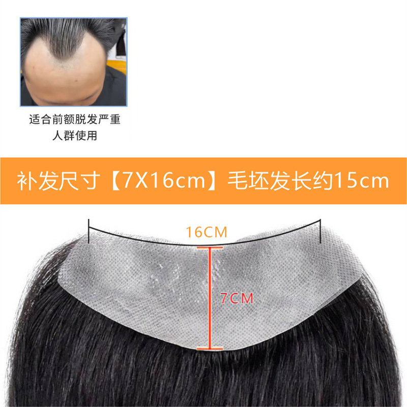发际线假发贴假刘海假发片m形发际线贴男一片式前额补发自然真发|undefined