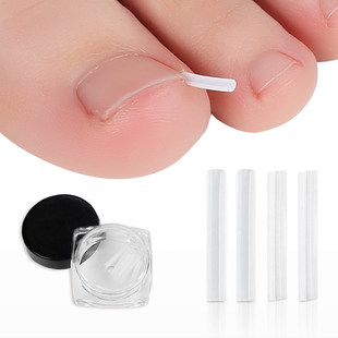 nail correction device nail inlay filling pad nail groove toenail long meat filling strip nail correction pad nail correction wire device