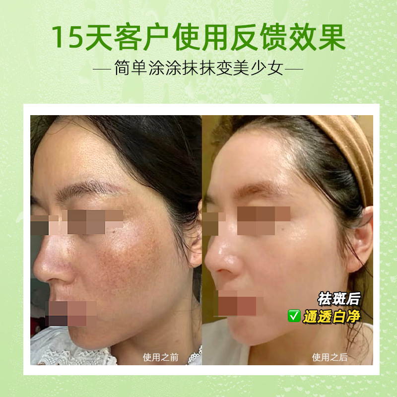 排铅汞祛斑液黄褐斑真皮斑排色液反黑精华液美白原液保养液代谢液|undefined