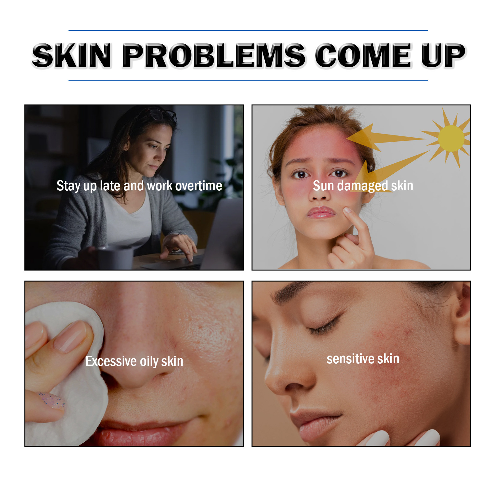 EELHOE Small Blue Bottle Removing Liquid Lightens Acne Marks, Firms Pores, Mildly Moisturizes and Repairs essence_voghion.com