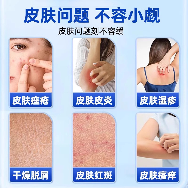 Yifangshuo 医療用湿式修復ドレッシングメーカーは、湿疹の外用修復に使用できる製品を迅速に発送するように直接指示しています。|undefined