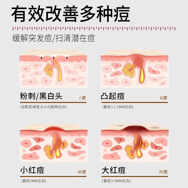 医用级祛痘霜祛痘膏淡化痘印水杨酸草本配方修护家用美容院清痘|undefined