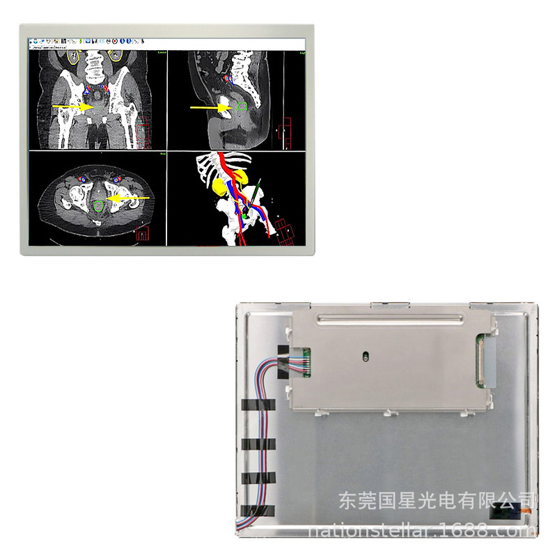 12.1inch Guangwang T-55788Gd121J-Lw-Agn Highlight Industrial Health Care Kyocera Lcd Module