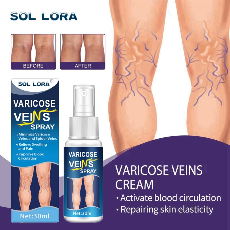 SOL LORA vein massage Qu Zhang spray smoothing blood vessel bulge skin care relieving earthworm leg spray