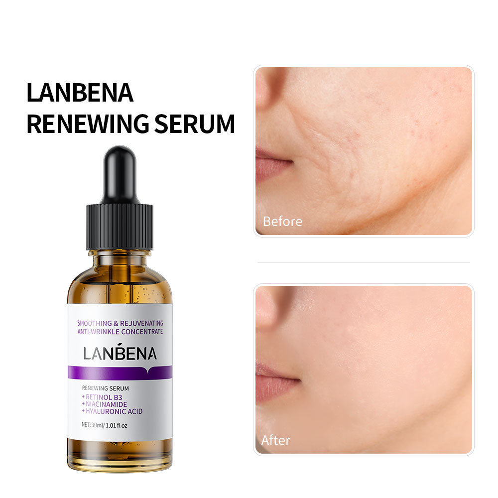 LANBENA New Facal Facial Essence (Brand) Renewing Serum