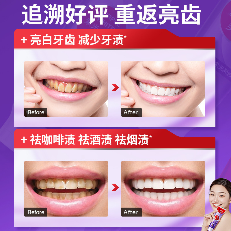 紫色のホワイトニング歯磨き粉100g、ホワイトニング、黄ばみ除去、タバコのヤニ除去、ディープクレンジング、息を爽やかに、歯を白くする、ネットで話題|undefined