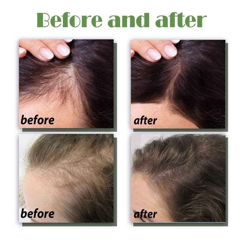 OUHOE ヘアケア スプレー 強化髪 栄養補給 修復 頭皮 スムーズで光沢のあるヘアケア スプレー|undefined