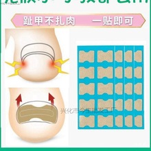 正甲贴甲沟嵌甲矫正器炎脚沟脚趾趾甲贴片纠正指甲长肉里神器套装