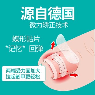 Fifth Generation Easy-To-Apply Butterfly-Shaped Stickers with Frosted Design, Nail Correction Device for Ingrown Nails, Nail Groove Pain Inflammation Buckle Hook Wire Cutting Pliers