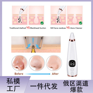 �¿�늄�ȥ���^ë���坍ȥ�۴���֬Ę���������݃x�����^�x