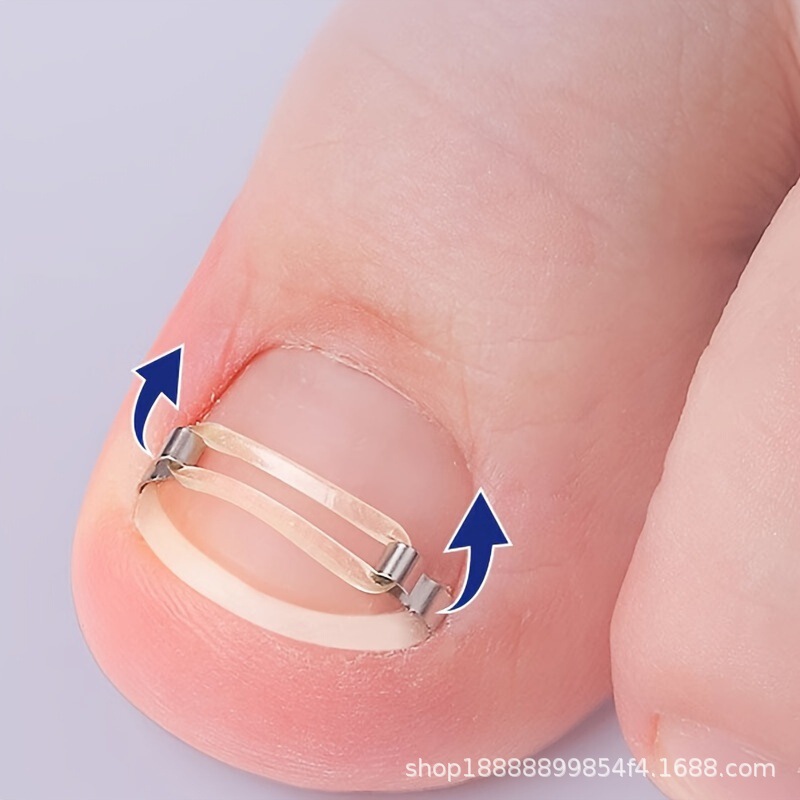 Large quantity of preferential packaging on-demand nail buckle suit inlay nail straightener toenail