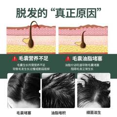 OEM Daohe Fashion Special Certificate Shampoo Scalp Care Keratin Salvia Herbal Anti-hair Loss Shampoo Customized