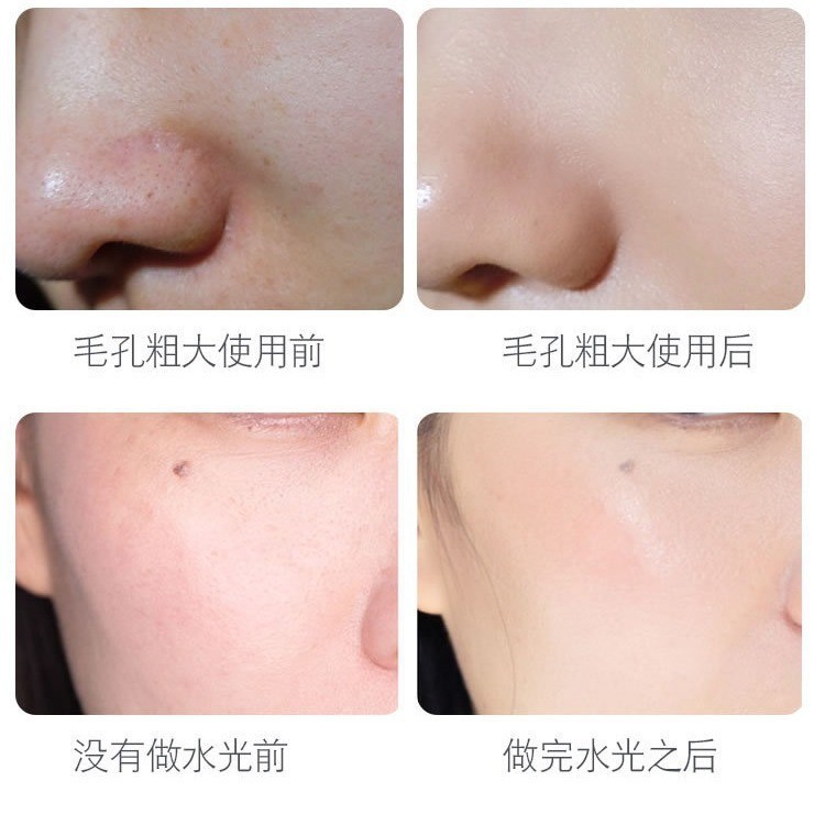 纳米电动微针仪器VC美容院导入飞梭针头纳米微晶笔水光枪|undefined