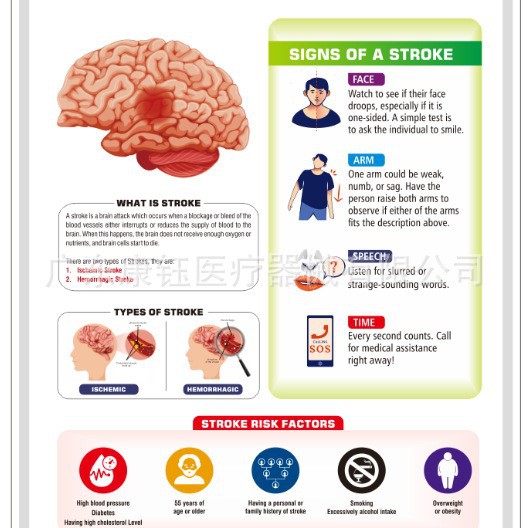 Stroke 60