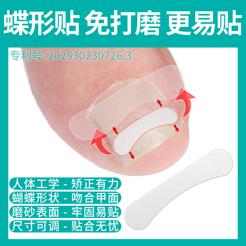 Fifth Generation Easy-To-Apply Butterfly-Shaped Stickers with Frosted Design, Nail Correction Device for Ingrown Nails, Nail Groove Pain Inflammation Buckle Hook Wire Cutting Pliers