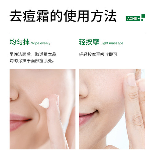 Acne Cream, Po Dieyu Ruyan Aloe Vera Gel, Acne Relief Lotion, Acne and Blackhead Cream, Wholesale Skincare Products