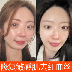 カンゾウ修復原液修復紅血糸増強厚角質層敏感筋美容院ホルモン顔修復原液