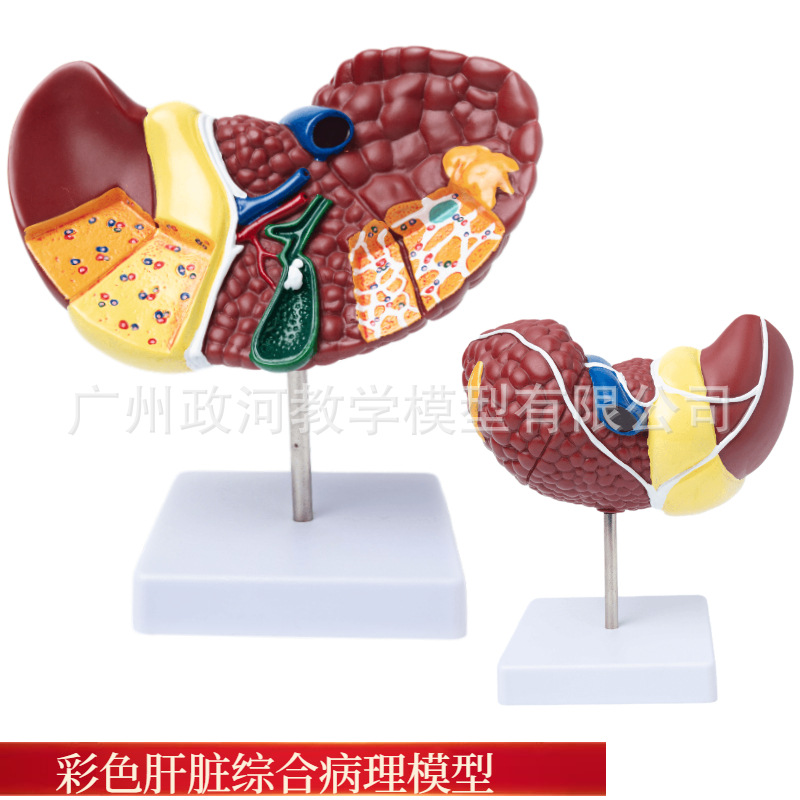 人体肝脏模型1比1解剖教学模型医学展示消化系统 病理肝解剖教具-阿里巴巴