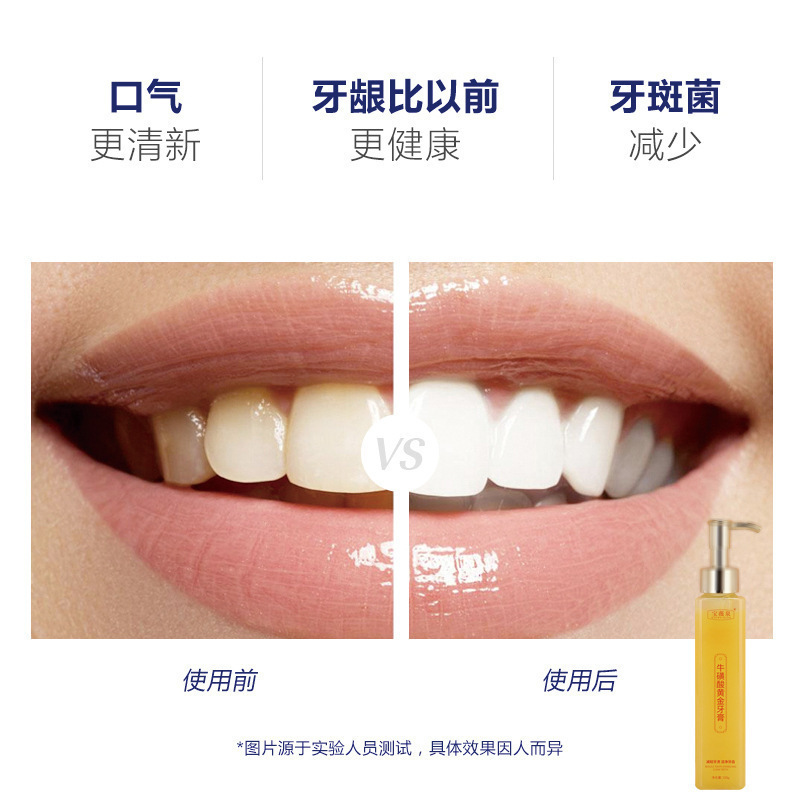 Baoweiquan タウリンゴールドフレグランス歯磨き粉プレス式歯磨き粉ゴールドファクター口臭除去歯磨き粉メーカー|undefined