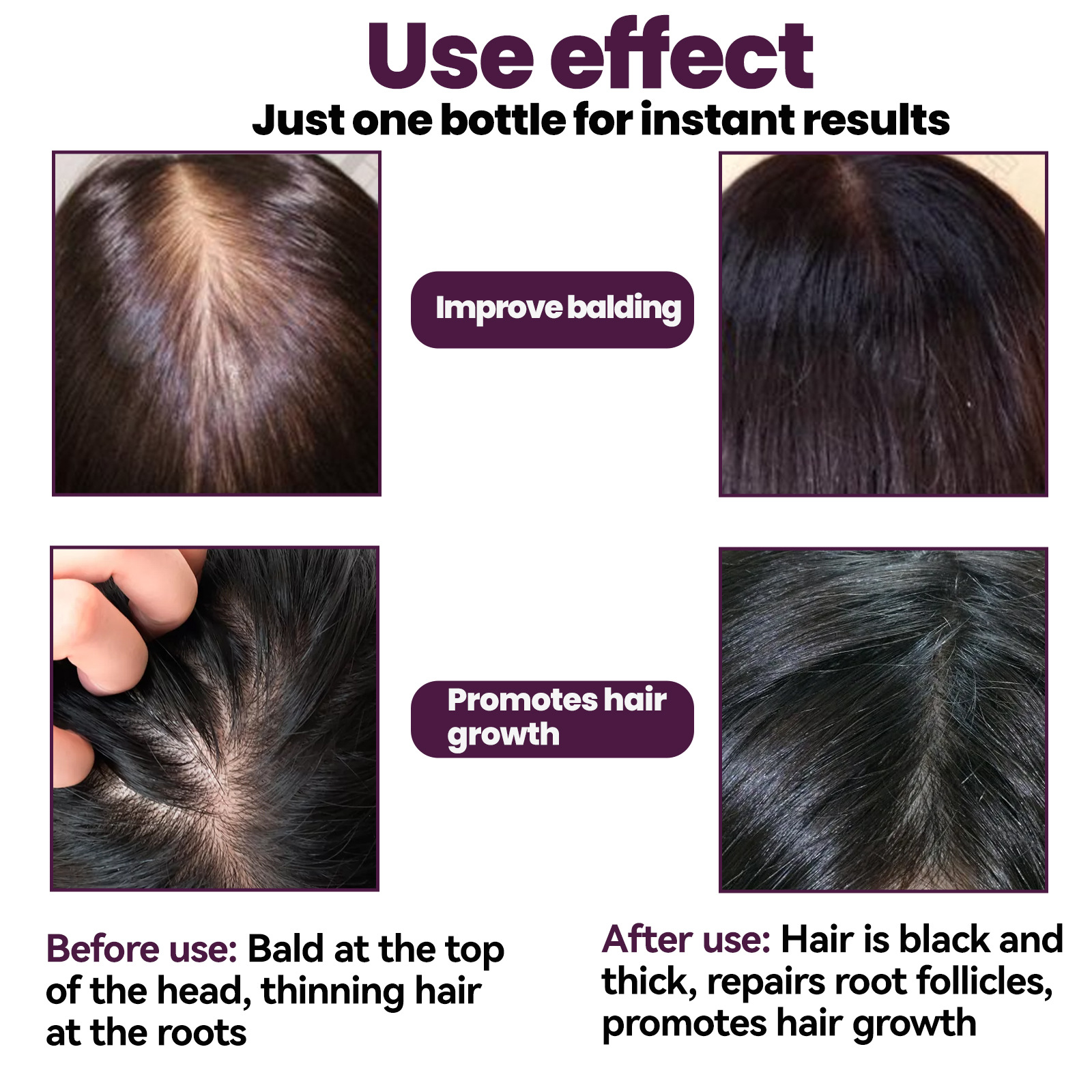 Cura della crescita in schiuma EELHOE, previene la perdita, stimola i follicoli, fa crescere i capelli, nutre e fissa i capelli_voghion.com