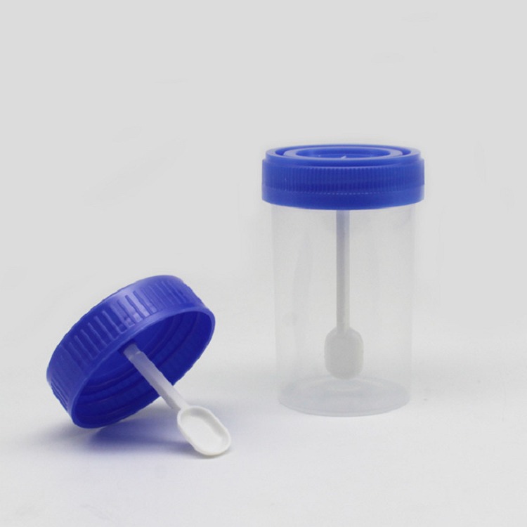 Suministro por lotes de tazas de muestreo de 40ml con tapa de tornillo, tazas de orina con tapa de tornillo grande y excelente