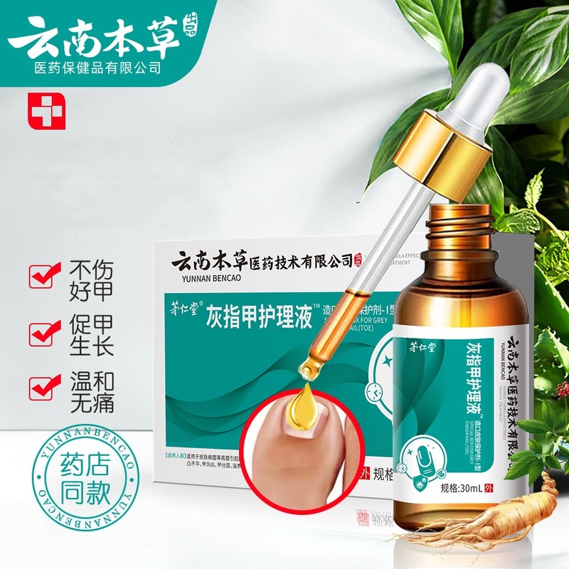 在庫あり Maorentang 雲南ハーブ爪真菌症ケアソリューション生爪ハーブ抗菌液体フットケア剤卸売配送|undefined