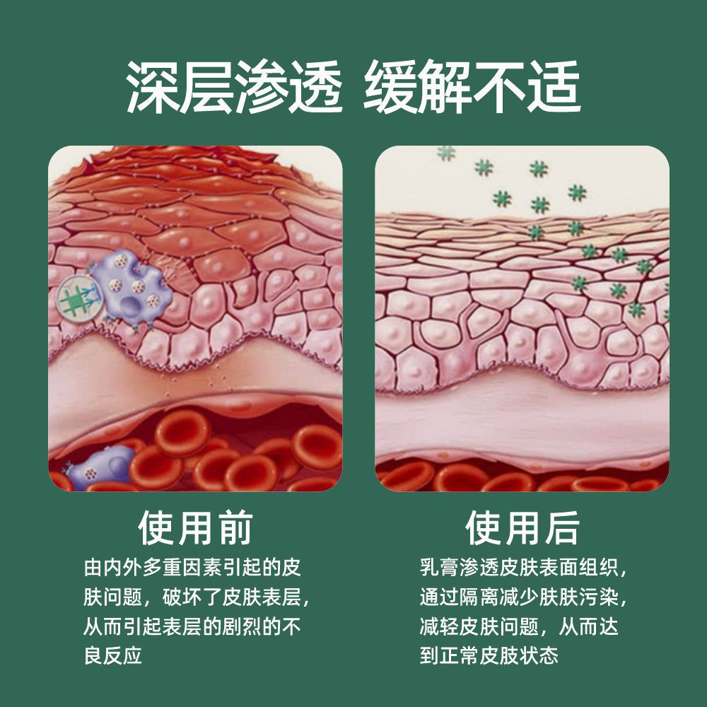 艾草止癢膏腳氣膏草本皮藏秘角質皮膚抑菌乳膏通用止癢軟膏