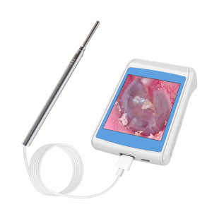 BX623.9mm��ҕ���R�ɶ��������b��ҕ�ڶ����Ͷ����Ĥ�ǃȸQ�R�x