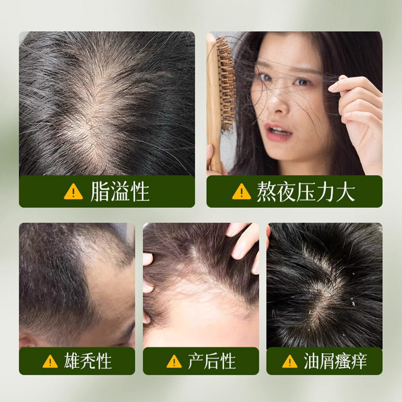 Bibaiya lado de la hoja de ciprella Usman anti-rotura champú jabón de hierbas fuerte cuidado del cabello jabón de cabello fábrica al por mayor image 3