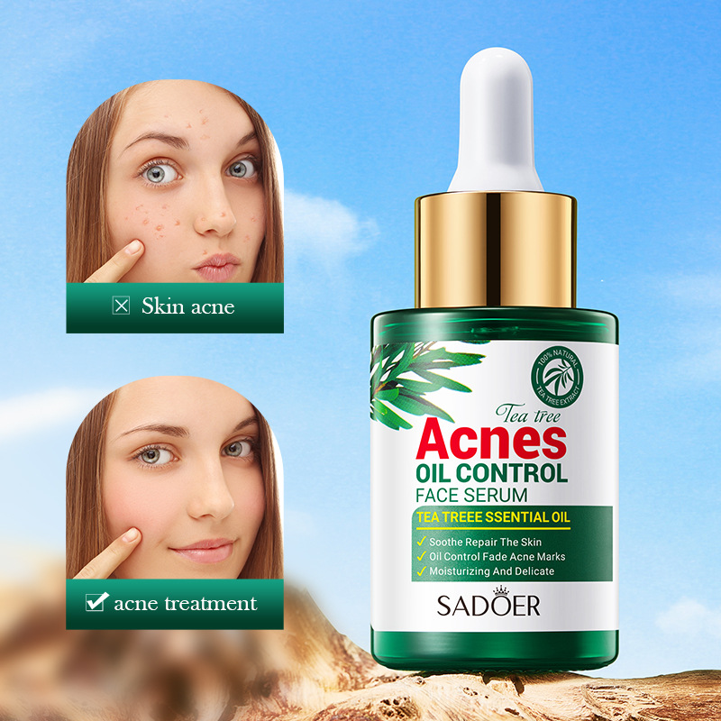 Tea Tree SADOER Removedor e Controlador de Óleo Líquido Impressão Produto para Cuidados com a Pele Hidratante Facial Anti Acne e_voghion.com