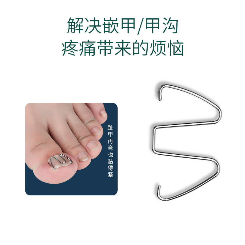 Ingrown Toenail Correction Tool for Correcting Ingrown Nails, Nail Groove Correction, Ingrown Toenail Correction, Toenail Correction Device, Pedicure Tool