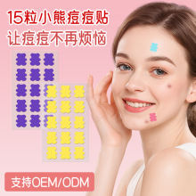 Acne Patch��ɫˮ�z�w�����N������N�˹�Ƥ�[���ޏͶ�ӡ�ڃ���