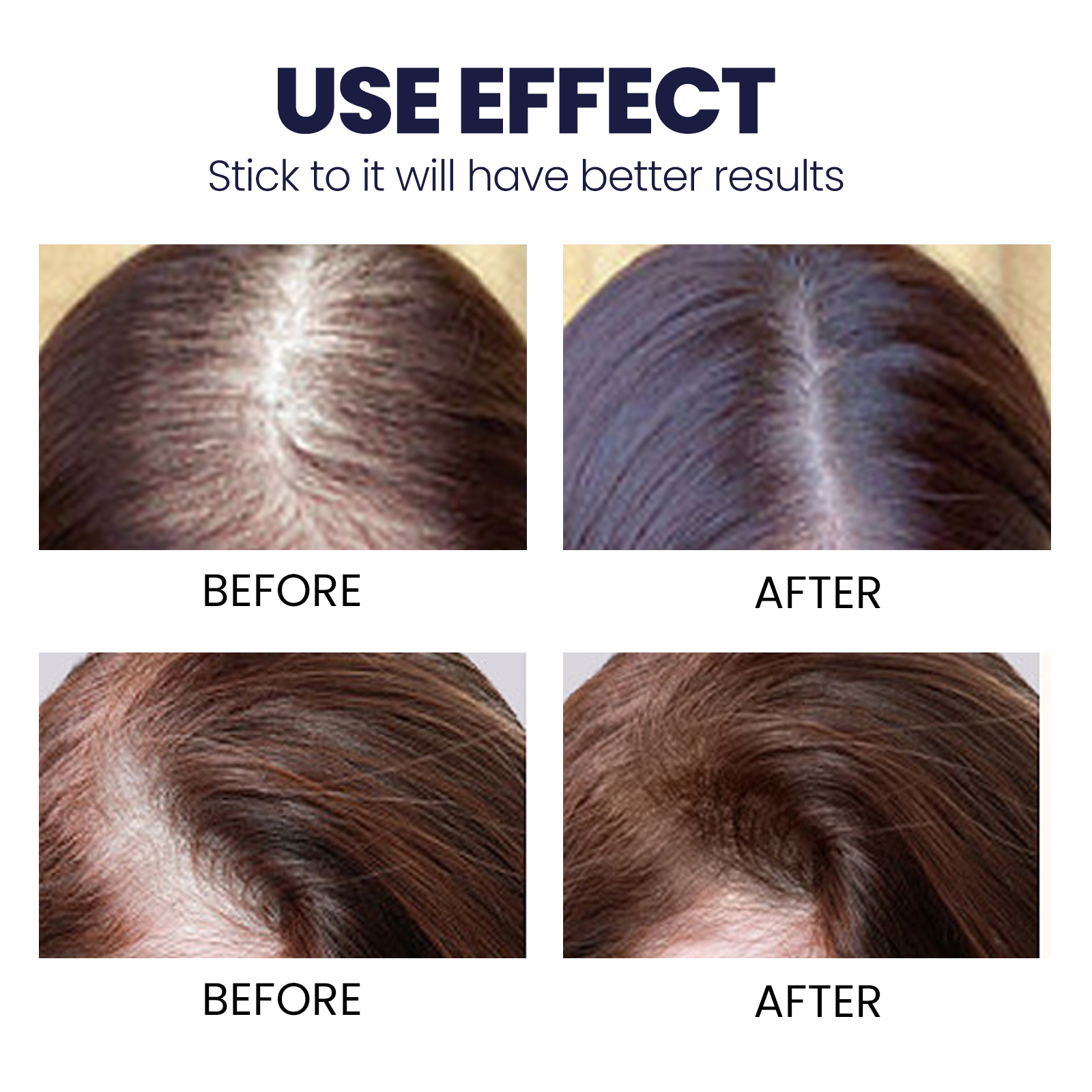 OUHOE Hair Mist