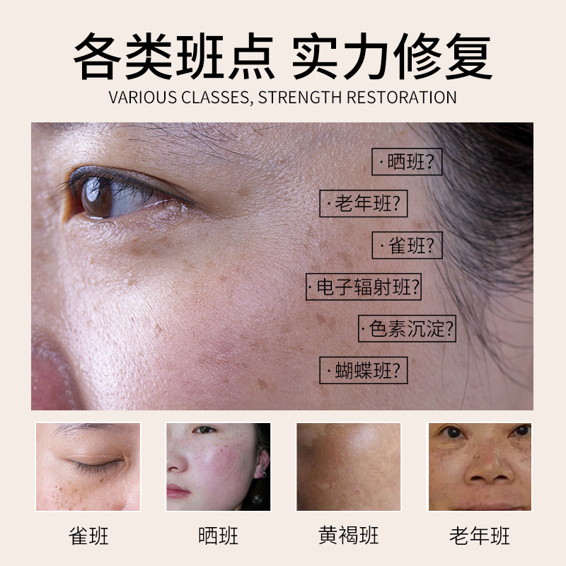 美容院溶斑液微晶免提取美白祛斑液排色液去雀斑真皮斑祛斑精华液|undefined