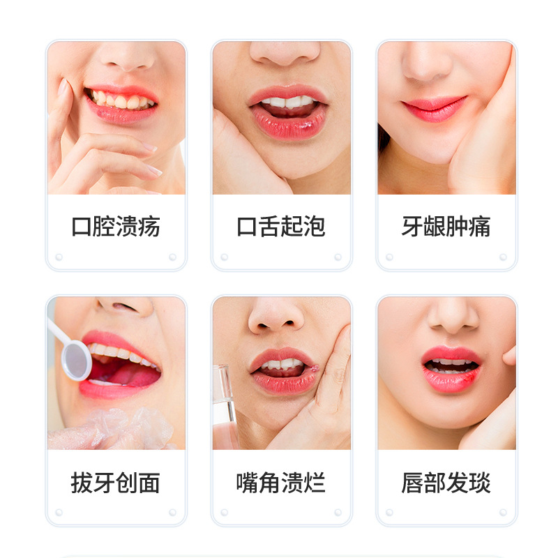 Gel de úlcera oral de girasol alivia la formación de espuma de la boca y la lengua, úlcera de la boca y las esquinas de la boca, el calor excesivo, la hinchazón y el dolor de la pomada para el cuidado de las encías