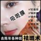 Hospital line spot-absorbing membrane 5-day membrane whitening freckle-absorbing blackhead Acne Cleansing skin membrane freckle-removing tear mask skin membrane